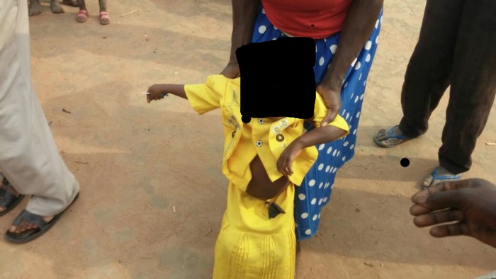 000000-enfantmalnutri-7a5